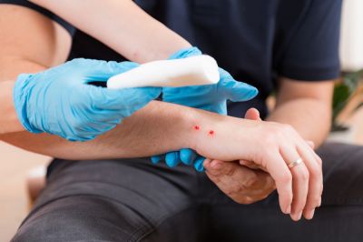 Avoid Snake Bites!